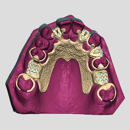 CAD / CAM